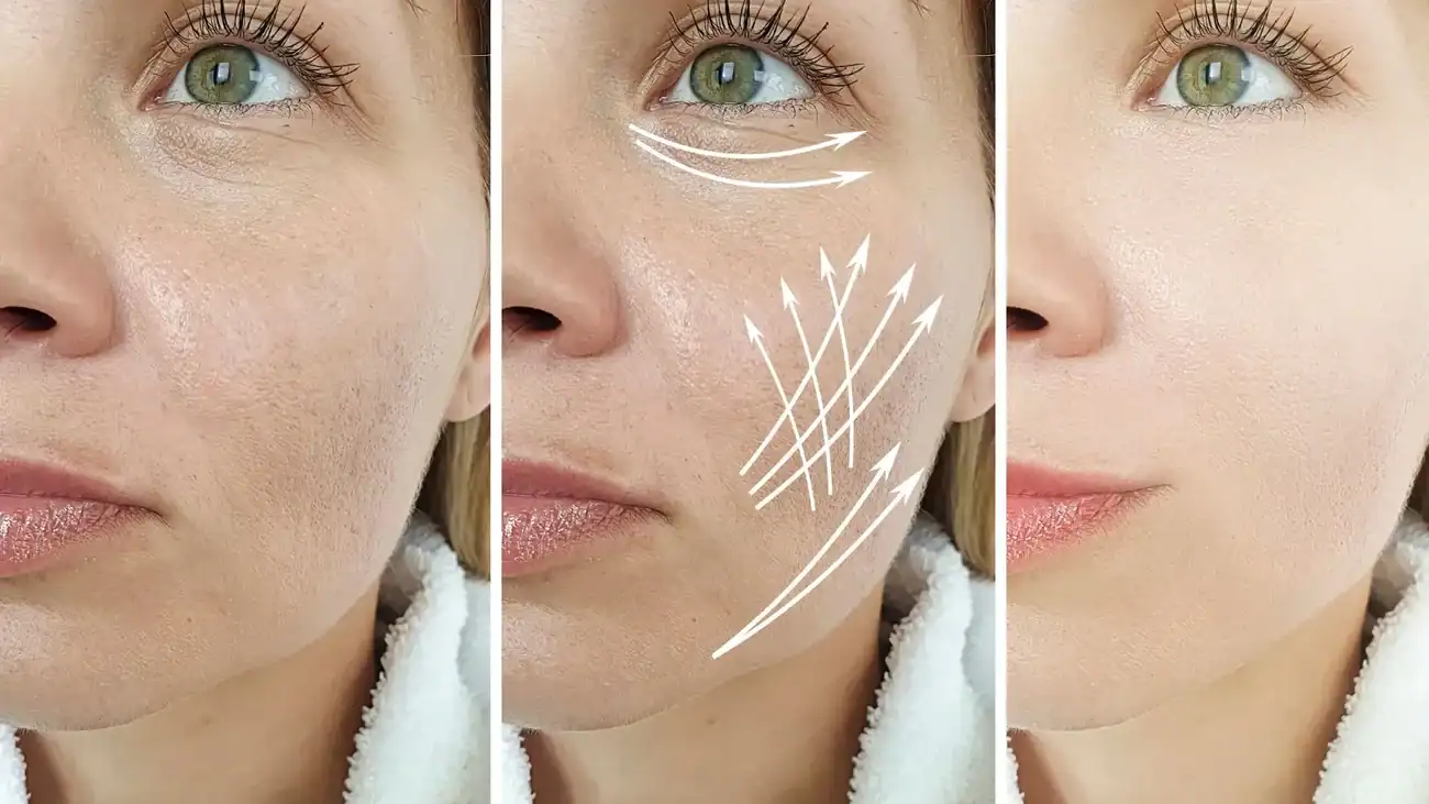 Can One Treatment Really Tackle More Than One Skin Concern Greenford?