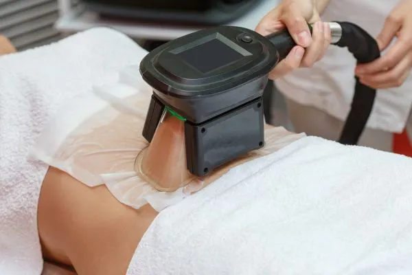 Image of person having fat freezing treatment to help weight gain Greenford