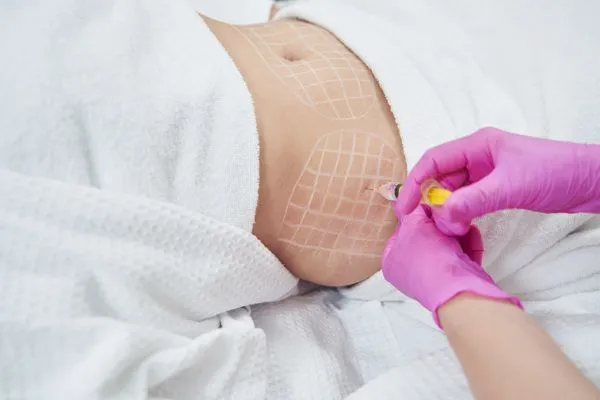image of fat dissolving injections on love handles to help combat weight gain Greenford