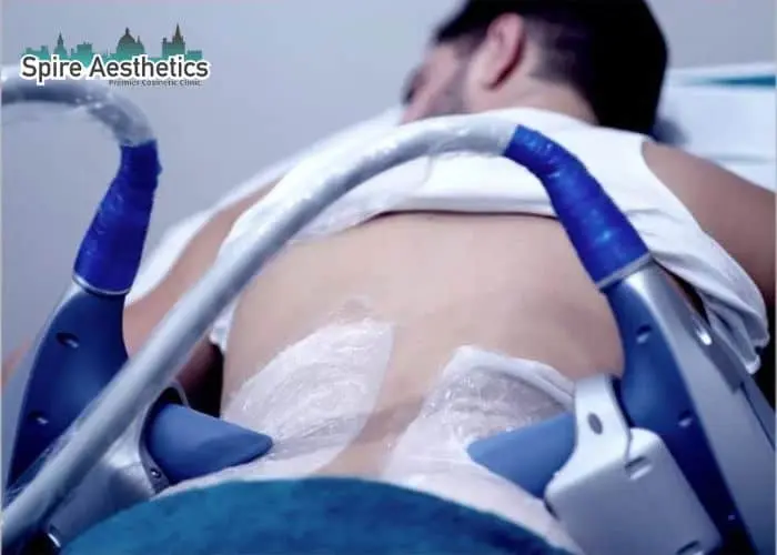 Man having fat freezing treatment done on love handles before a competitions Greenford to create a sculpted look.