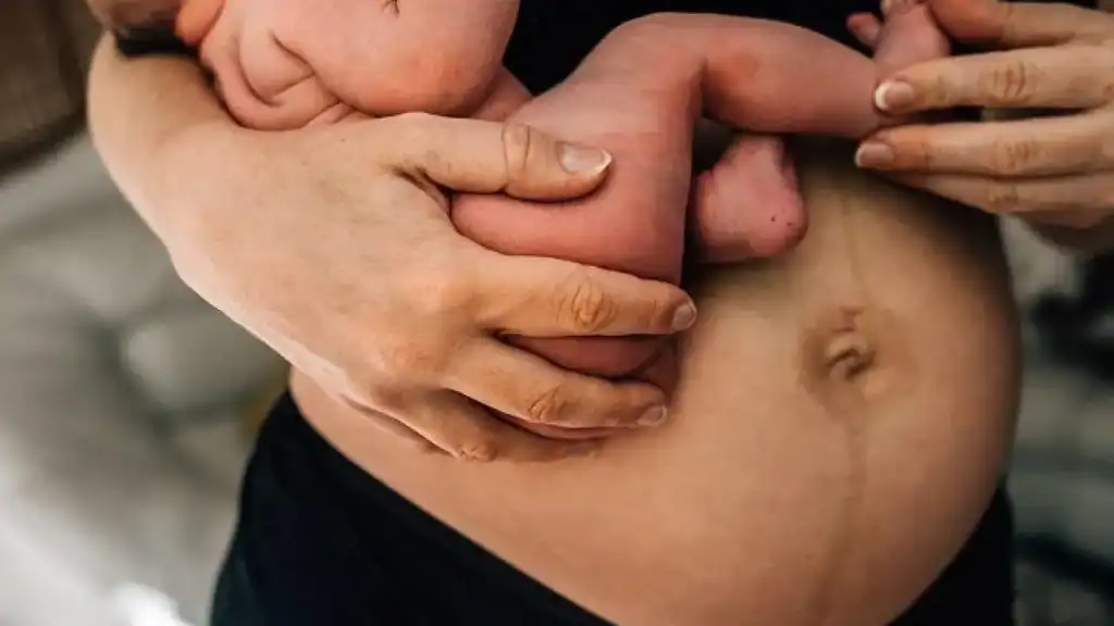 Why Is My Stomach Still Big After Pregnancy Greenford?