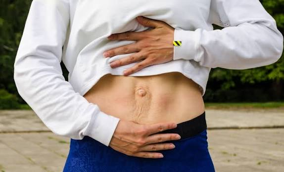 When Could Diastasis Recti Be the Missing Piece of the Puzzle Greenford?